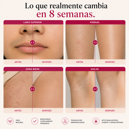 Aceite Cyprela® Inhibidor de Vello